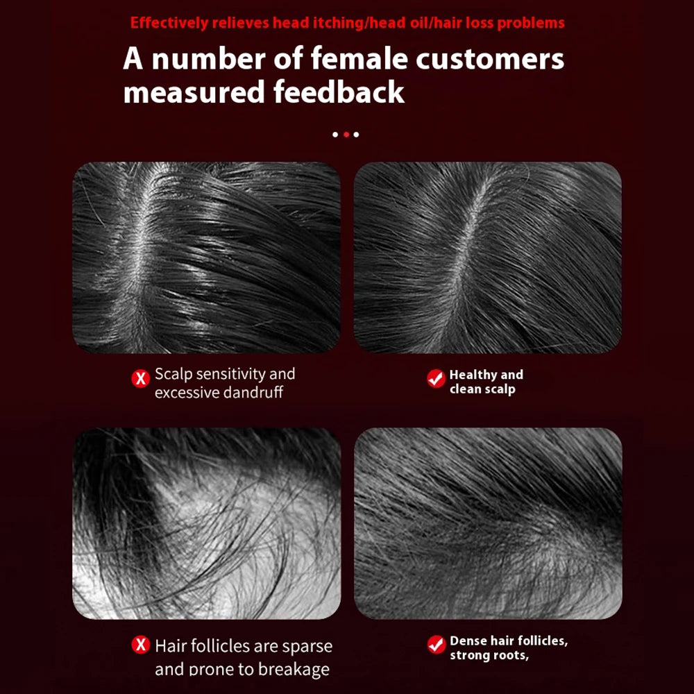 RevitaGlow- Anti-Hair Loss & Hair Regrowth Technology